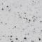 White Speckled